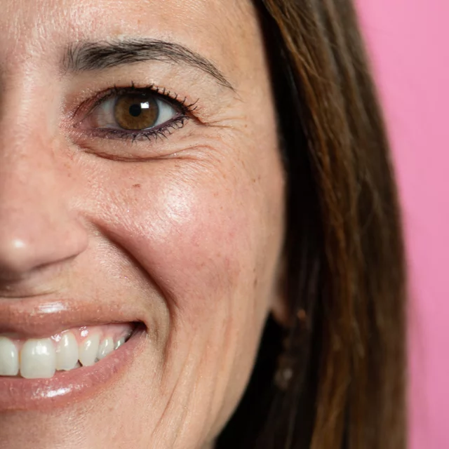 Immagine trattamento full skin care - Dopo