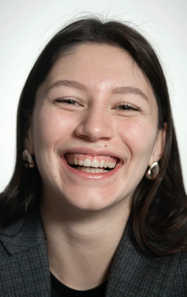 Prima del trattamento gummy smile